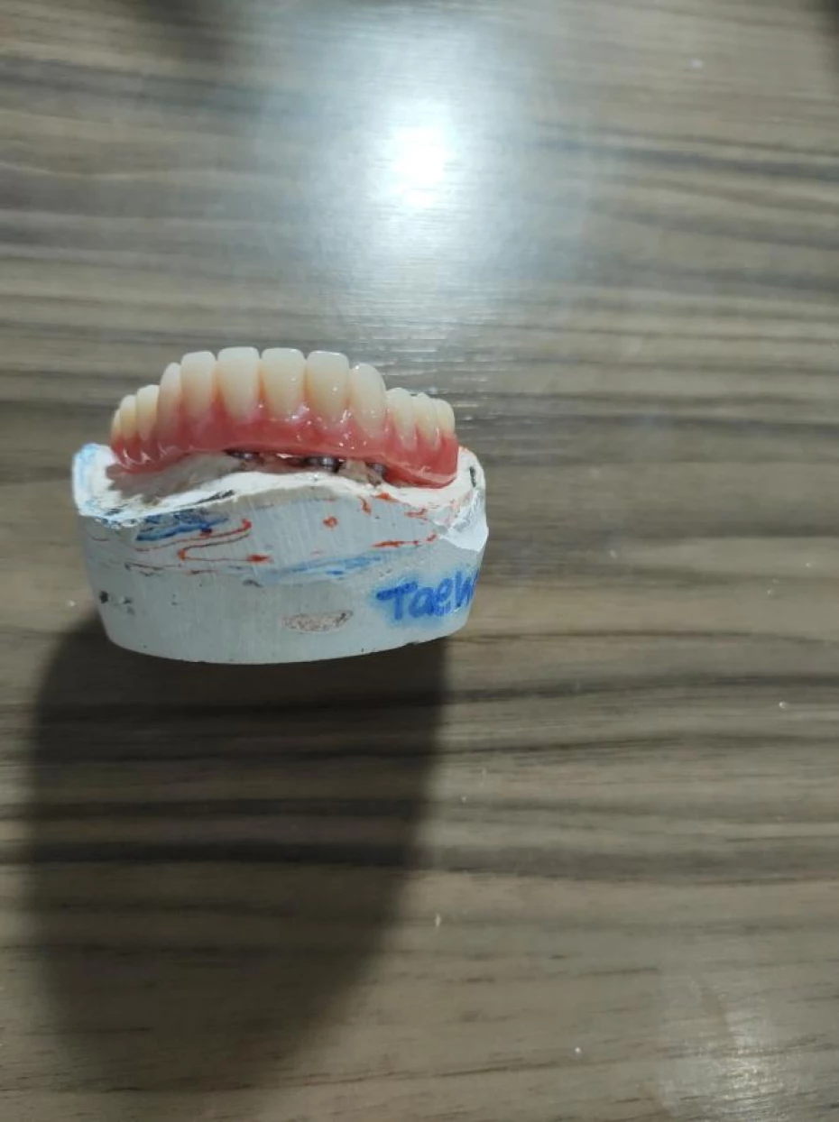 Foto 7:  — L.A Laboratório de Prótese Dentária