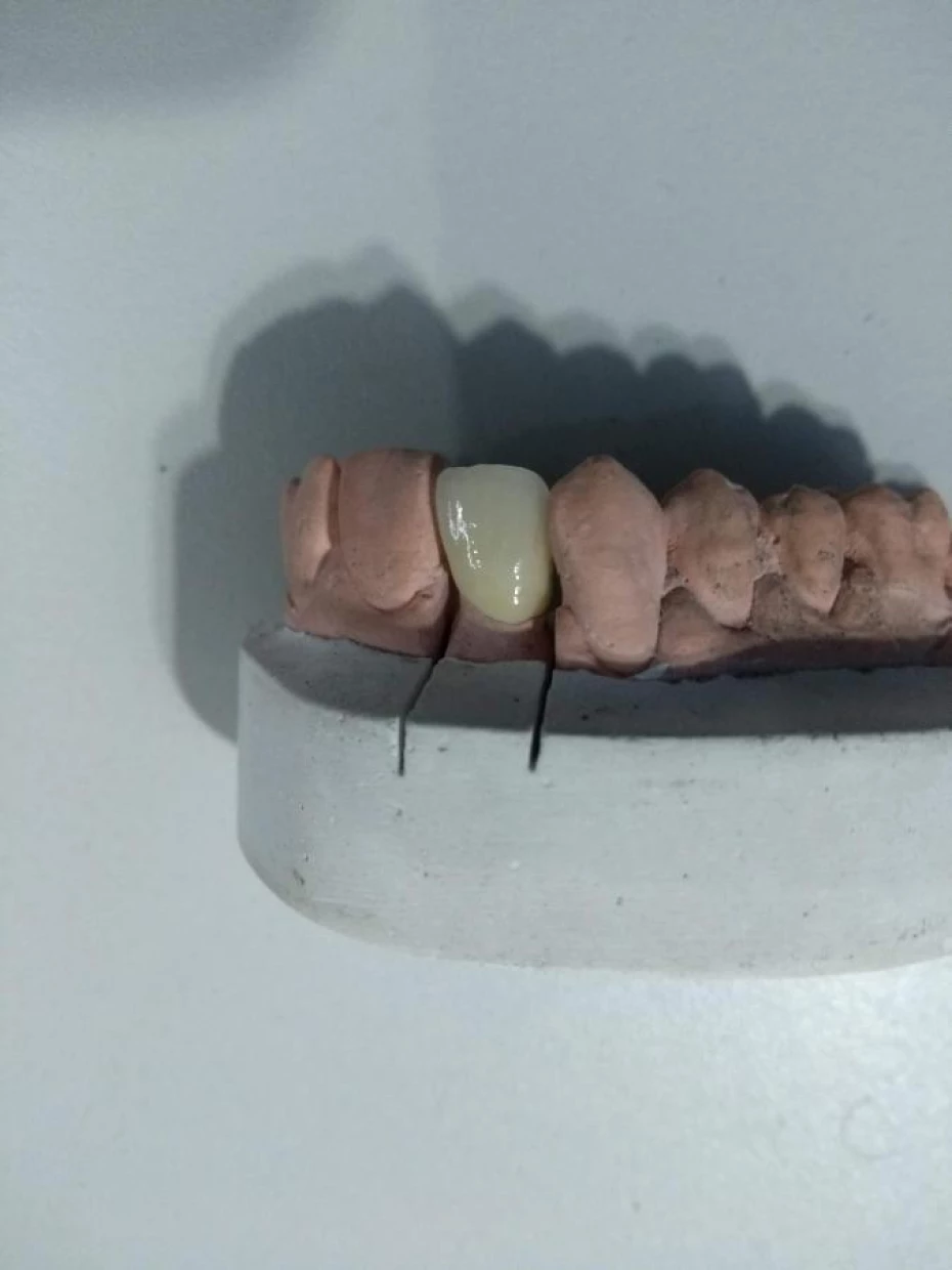 Foto 4:  — L.A Laboratório de Prótese Dentária