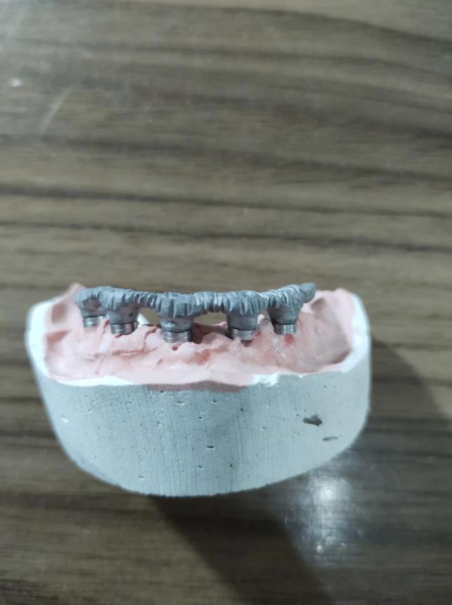 Foto 3:  — L.A Laboratório de Prótese Dentária