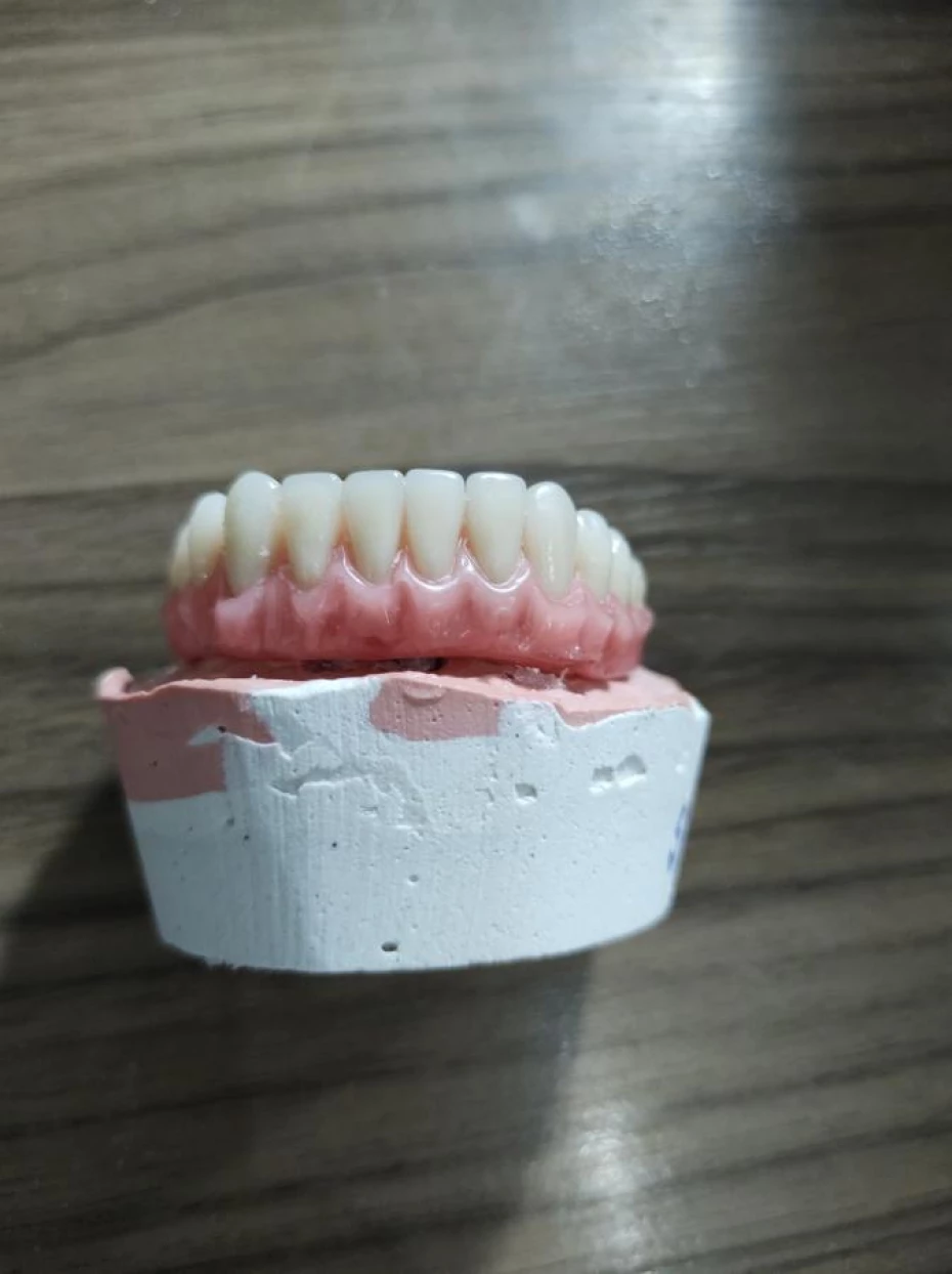 Foto 2:  — L.A Laboratório de Prótese Dentária