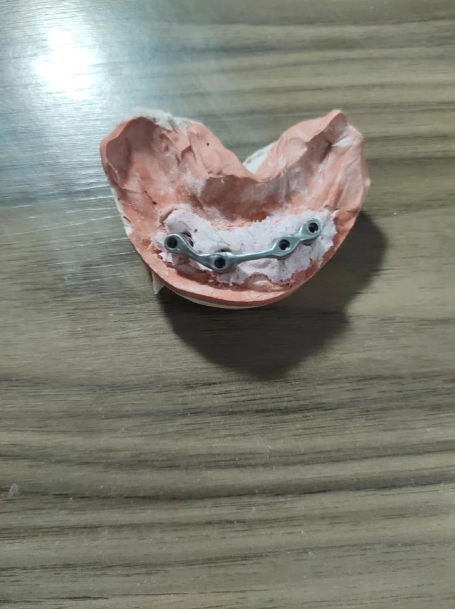 Foto 1:  — L.A Laboratório de Prótese Dentária